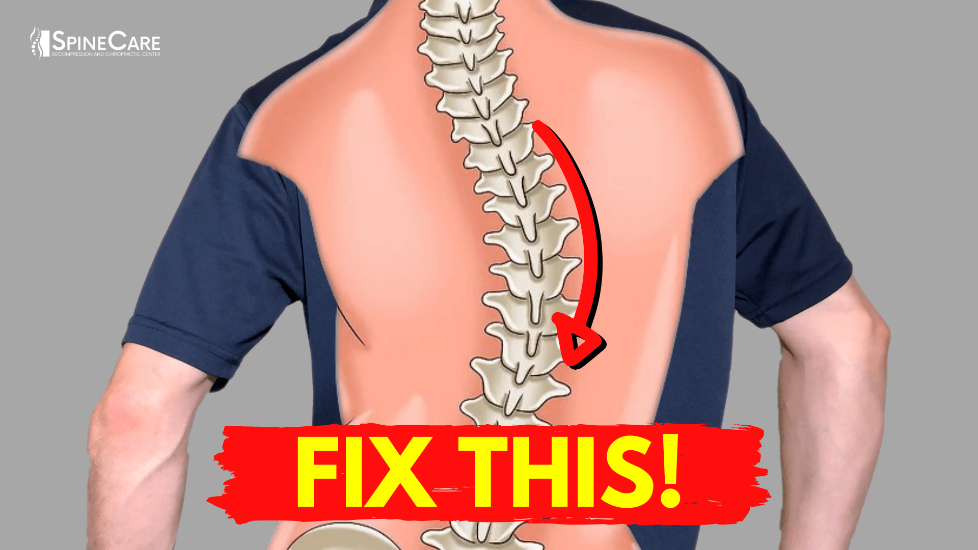 back pain scoliosis and arthritis best mattress for